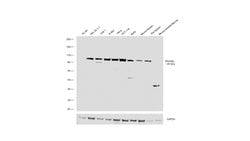 Invitrogen RNaseL Polyclonal Antibody 100 &mu;L; Unconjugated:Antibodies,