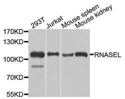 Invitrogen RNaseL Polyclonal Antibody 100 &mu;L; Unconjugated:Antibodies,