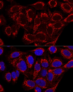 Invitrogen MRPS16 Polyclonal Antibody 100 &mu;L; Unconjugated:Antibodies,