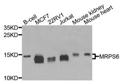 MRPS6 Polyclonal Antibody:Antibodies, Polyclonal