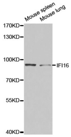 Invitrogen IFI16 Polyclonal Antibody 100 &mu;L | Buy Online | Invitrogen&trade; | Fisher Scientific