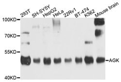 Invitrogen AGK Polyclonal Antibody 100 &mu;L; Unconjugated:Antibodies,