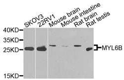 Invitrogen MYL6B Polyclonal Antibody 100 &mu;L; Unconjugated:Antibodies,