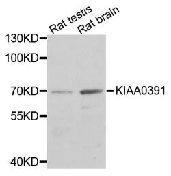 Invitrogen KIAA0391 Polyclonal Antibody 100 &mu;L; Unconjugated:Antibodies,