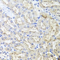 Invitrogen LRP2 Polyclonal Antibody 100 &mu;L; Unconjugated:Antibodies,