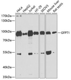 Invitrogen GFPT1 Polyclonal Antibody 100 &mu;L; Unconjugated:Antibodies,