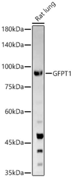 Invitrogen GFPT1 Polyclonal Antibody 100 &mu;L; Unconjugated:Antibodies,