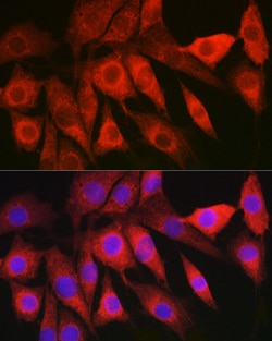 Invitrogen LAMTOR5 Polyclonal Antibody 100 &mu;L; Unconjugated:Antibodies,