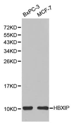 Invitrogen LAMTOR5 Polyclonal Antibody 100 &mu;L; Unconjugated:Antibodies,