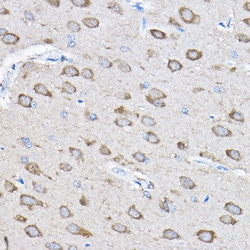 Invitrogen PTPN23 Polyclonal Antibody 100 &mu;L; Unconjugated:Antibodies,