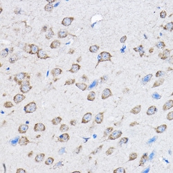 Invitrogen PTPN23 Polyclonal Antibody 100 &mu;L; Unconjugated:Antibodies,