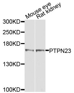 Invitrogen PTPN23 Polyclonal Antibody 100 &mu;L; Unconjugated:Antibodies,