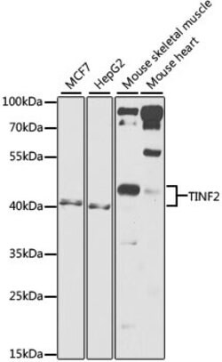 Invitrogen TIN2 Polyclonal Antibody 100 &mu;L | Buy Online | Invitrogen&trade; | Fisher Scientific