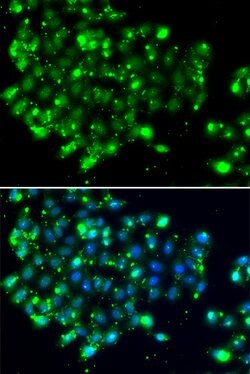 Invitrogen NAT9 Polyclonal Antibody 100 &mu;L; Unconjugated:Antibodies,