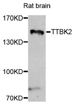 Invitrogen TTBK2 Polyclonal Antibody 100 &mu;L; Unconjugated:Antibodies,