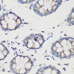 Invitrogen GluD1 Polyclonal Antibody 100 &mu;L; Unconjugated:Antibodies,