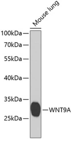 Invitrogen WNT9A Polyclonal Antibody 100 &mu;L | Buy Online | Invitrogen&trade; | Fisher Scientific