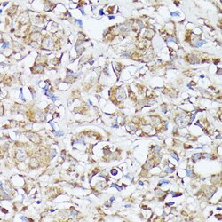 Invitrogen MTHFD2 Polyclonal Antibody 100 &mu;L; Unconjugated:Antibodies,