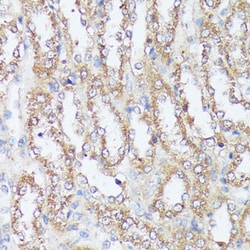 Invitrogen MTHFD2 Polyclonal Antibody 100 &mu;L; Unconjugated:Antibodies,