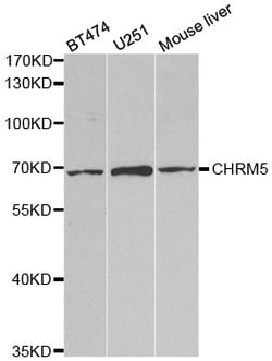 Invitrogen CHRM5 Polyclonal Antibody 100 &mu;L | Buy Online | Invitrogen&trade; | Fisher Scientific