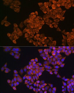Invitrogen SQLE Polyclonal Antibody 100 &mu;L; Unconjugated:Antibodies,