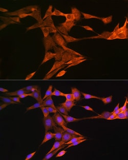 Invitrogen SQLE Polyclonal Antibody 100 &mu;L; Unconjugated:Antibodies,