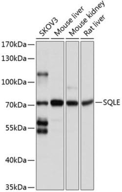 Invitrogen SQLE Polyclonal Antibody 100 &mu;L; Unconjugated:Antibodies,
