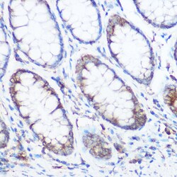 Invitrogen NOMO1 Polyclonal Antibody 100 &mu;L; Unconjugated:Antibodies,
