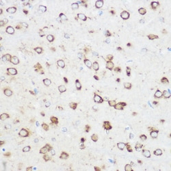 Invitrogen NOMO1 Polyclonal Antibody 100 &mu;L; Unconjugated:Antibodies,