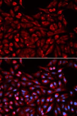 Invitrogen MB67 Polyclonal Antibody 100 &mu;L; Unconjugated:Antikroppar