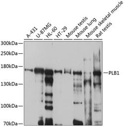 Invitrogen PLB1 Polyclonal Antibody 100 &mu;L; Unconjugated:Antibodies,