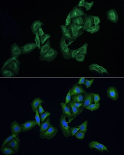 Invitrogen AGTRAP Polyclonal Antibody 100 &mu;L; Unconjugated:Antibodies,
