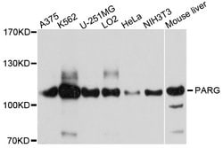 Invitrogen PARG Polyclonal Antibody 100 &mu;L; Unconjugated:Antibodies,