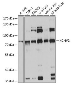 Invitrogen KCNV2 Polyclonal Antibody 100 &mu;L; Unconjugated:Antibodies,