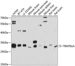 Invitrogen TRMT61A Polyclonal Antibody 100 &mu;L | Buy Online | Invitrogen&trade; | Fisher Scientific