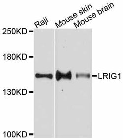 Invitrogen LRIG1 Polyclonal Antibody 100 &mu;L; Unconjugated:Antibodies,