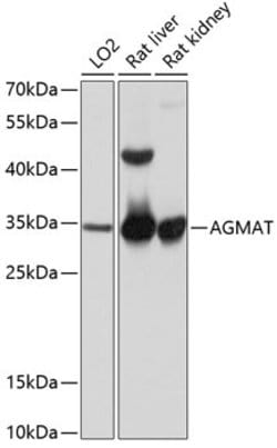 Invitrogen AGMAT Polyclonal Antibody 100 &mu;L; Unconjugated:Antibodies,
