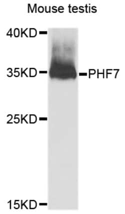 Invitrogen PHF7 Polyclonal Antibody 100 &mu;L; Unconjugated:Antibodies,