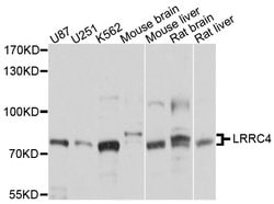 Invitrogen LRRC4 Polyclonal Antibody 100 &mu;L; Unconjugated:Antibodies,