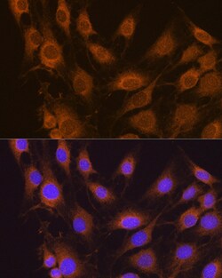 Invitrogen SEL1L Polyclonal Antibody 100 &mu;L; Unconjugated:Antibodies,