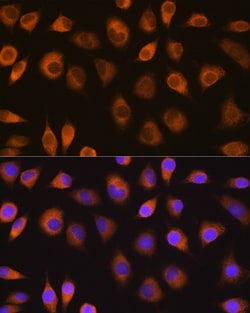 Invitrogen SEL1L Polyclonal Antibody 100 &mu;L; Unconjugated:Antibodies,