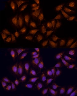 Invitrogen AGPS Polyclonal Antibody 100 &mu;L; Unconjugated:Antibodies,