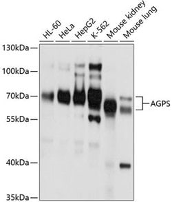 Invitrogen AGPS Polyclonal Antibody 100 &mu;L; Unconjugated:Antibodies,