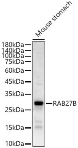 Invitrogen RAB27B Polyclonal Antibody 100 &mu;L; Unconjugated:Antibodies,