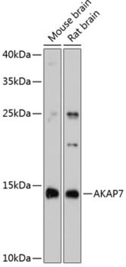Invitrogen AKAP7 Polyclonal Antibody 100 &mu;L | Buy Online | Invitrogen&trade; | Fisher Scientific