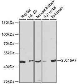 Invitrogen MCT2 Polyclonal Antibody 100 &mu;L; Unconjugated:Antibodies,