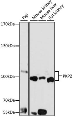 Invitrogen PKP2 Polyclonal Antibody 100 &mu;L; Unconjugated:Antibodies,