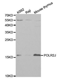 POLR2J Polyclonal Antibody 100 &mu;L | Buy Online | Thermo Scientific | Fisher Scientific