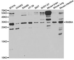 Invitrogen RAB6A Polyclonal Antibody 100 &mu;L; Unconjugated:Antibodies,