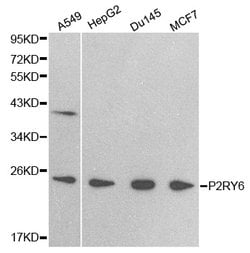 Invitrogen&trade;&nbsp;P2Y6 Polyclonal Antibody